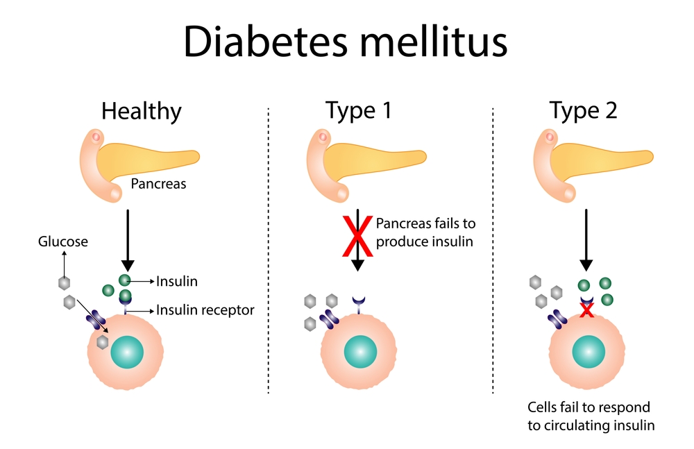 People with diabetes may soon be able to take insulin by mouth.