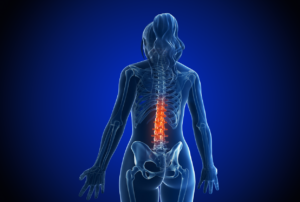 Estrogen and Low Back Pain: What the Research Shows as shown by a woman with lower back pain